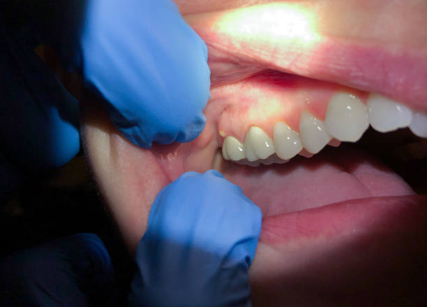 Best Walk-In Emergency Dentist in Chinchilla, PA